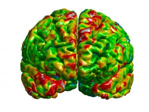 Image of the frontal cortex depicting quantitative radiology