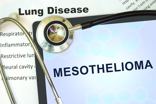 Mesothelioma sign with stethoscope.