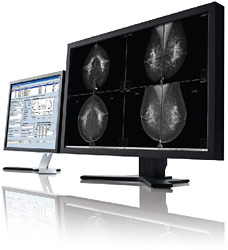 Carestream Mammography PACS Workstation
