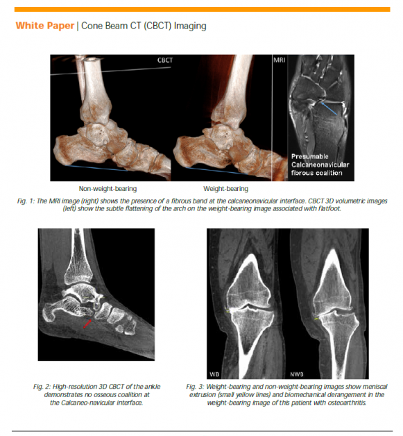 Carestream CBCT Weight Bearing Images