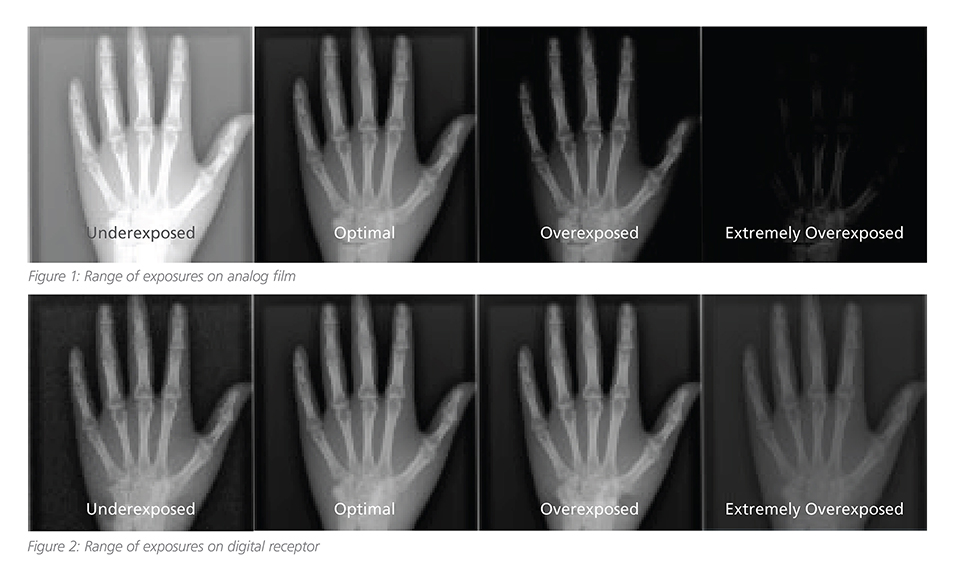 Digital Radiography Comparison Chart