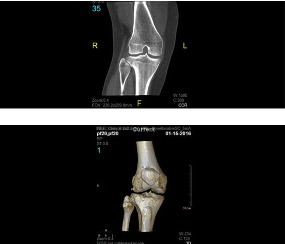 2D and 3D orthopaedic renderings generated by the CBCT scanner