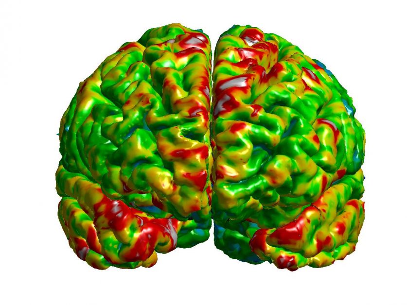 Image of the frontal cortex