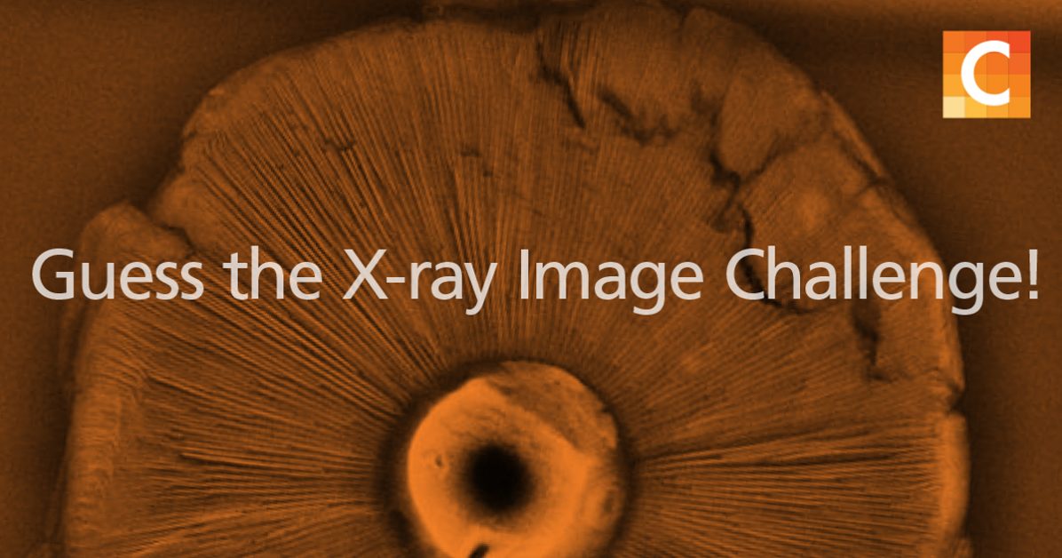what is exposure index in radiology