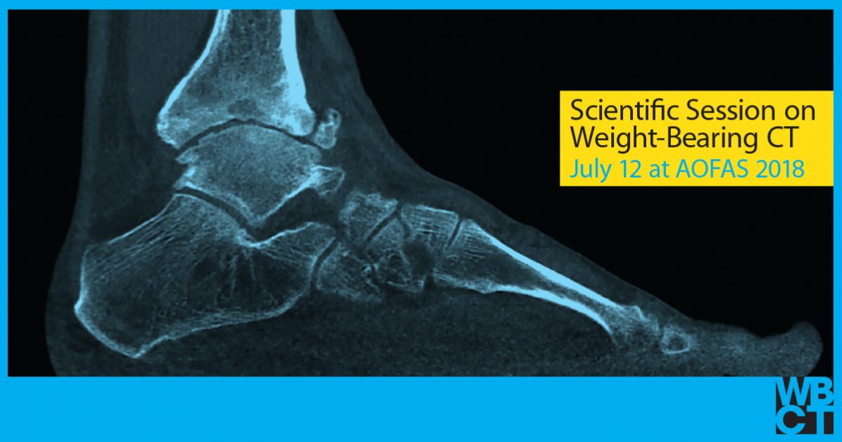 radiograph of foot