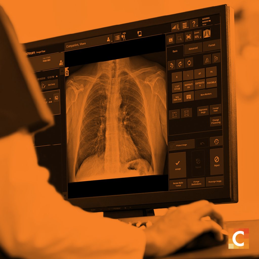 Photo of an X-ray scan with orange overlay and Carestream logo in the bottom right corner. 