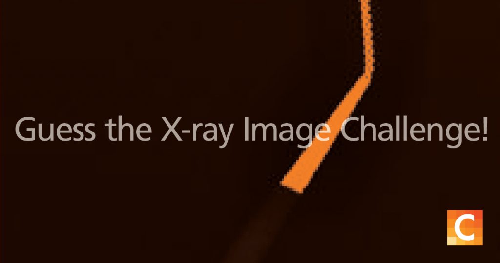 Guess the X-ray image challenge!