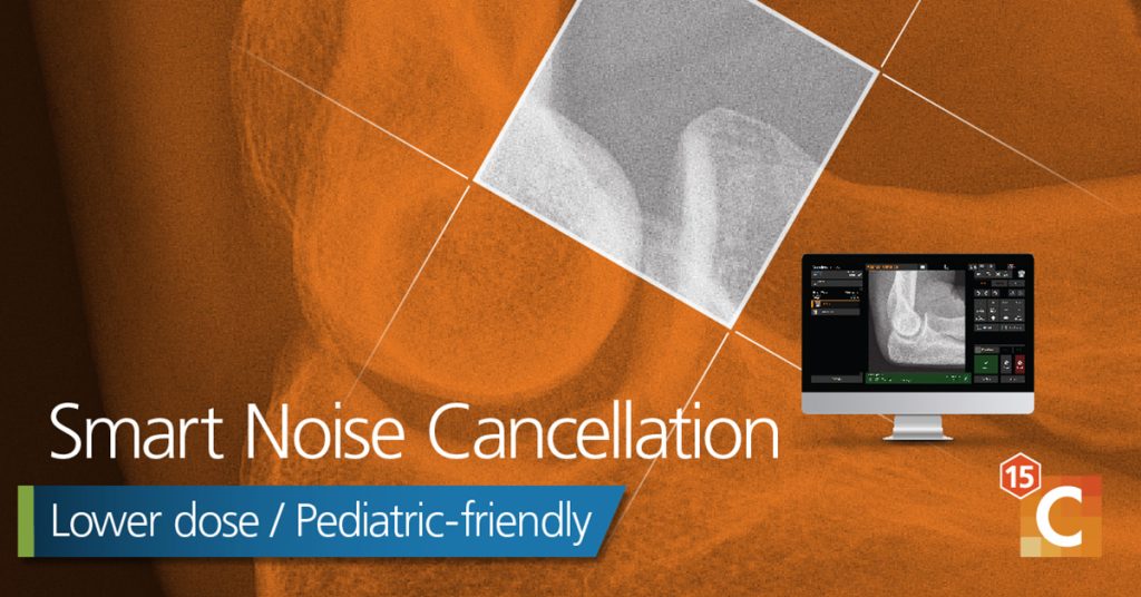 SNC provides image quality that will increase workflow to radiologist when with a patient. 