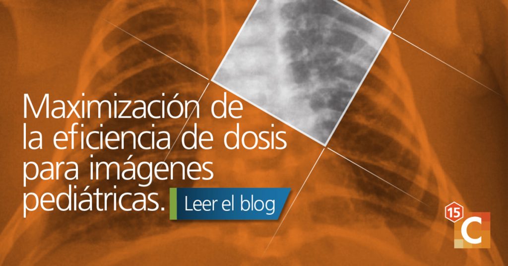 Es importante tener una dosis de radiación más baja para los niños en crecimiento para que no dañe los huesos y órganos en crecimiento.