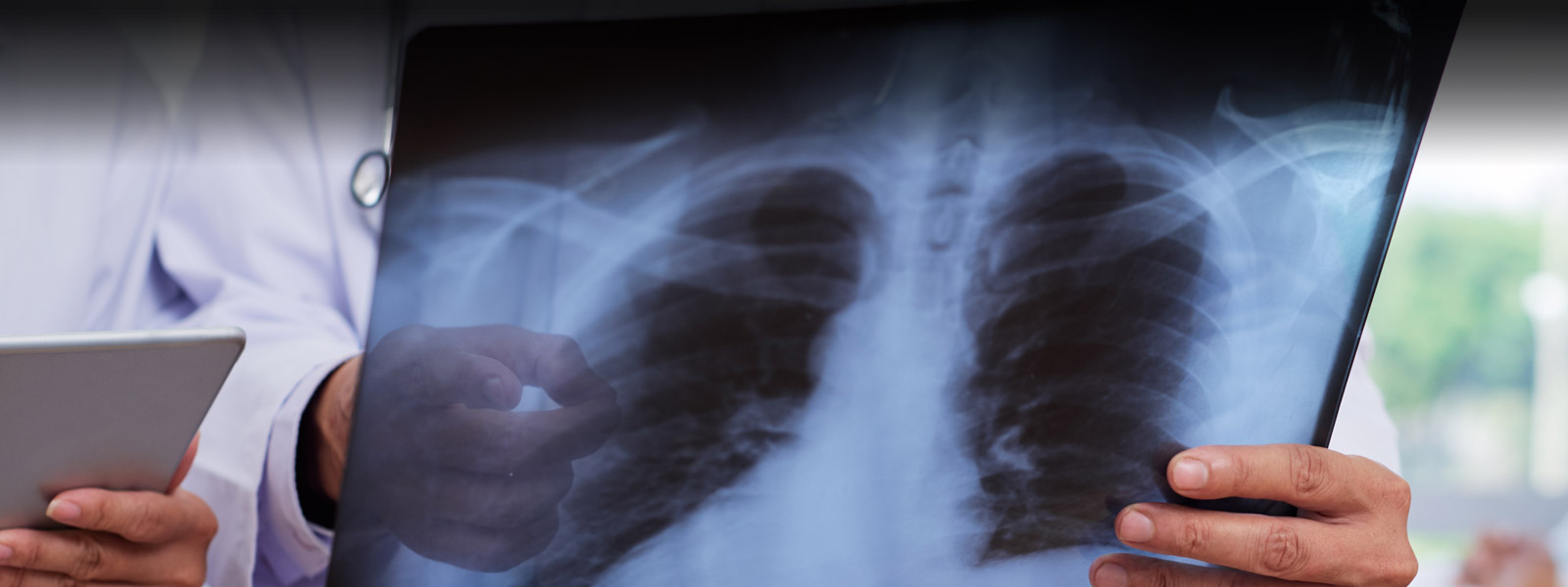 Laser x ray film store