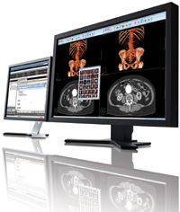 CARESTREAM RIS-PACS