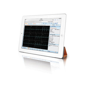 Vue Motion ECG