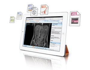 University of Iowa Health Care Purchases Carestream’s Enterprise Viewer, Lesion Management and Mammography Modules