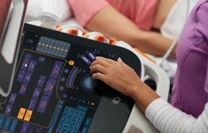 CARESTREAM Touch Prime XE Ultrasound System