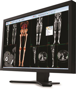 CARESTREAM Vue Radiology PACS