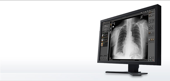 Image Suite Computed Radiography Carestream