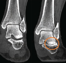 Cone Beam Ct Onsight 3d Extremity System Carestream