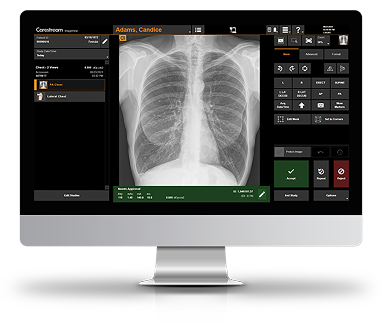 ImageView_Monitor