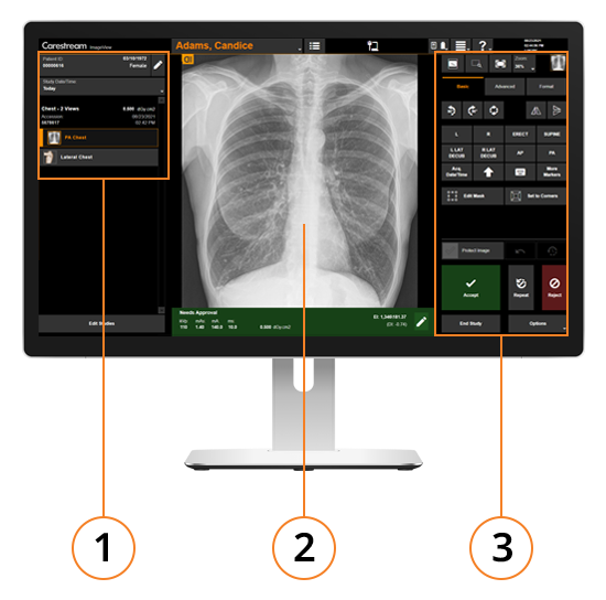 ImageView Software