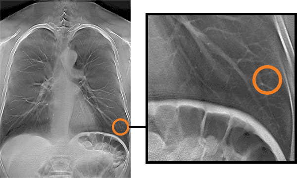 Slice of DT image showing pathology / Multiple slices showing pathology