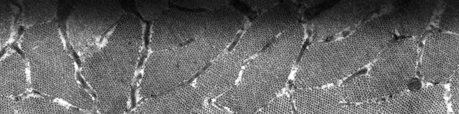 Películas para micrografías electrónicas de Carestream