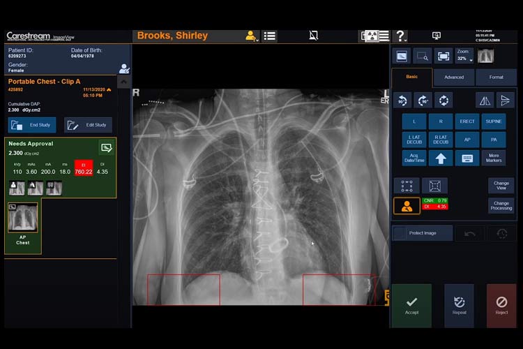 Aplicación de asistencia técnica con el software Carestream ImageView