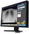 Software de radiografía