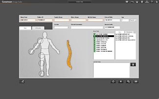 Image Suite: lista de trabajo