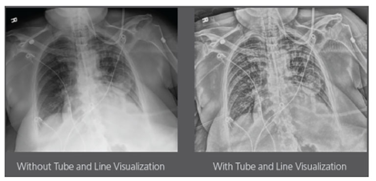 Simple and Effective Design