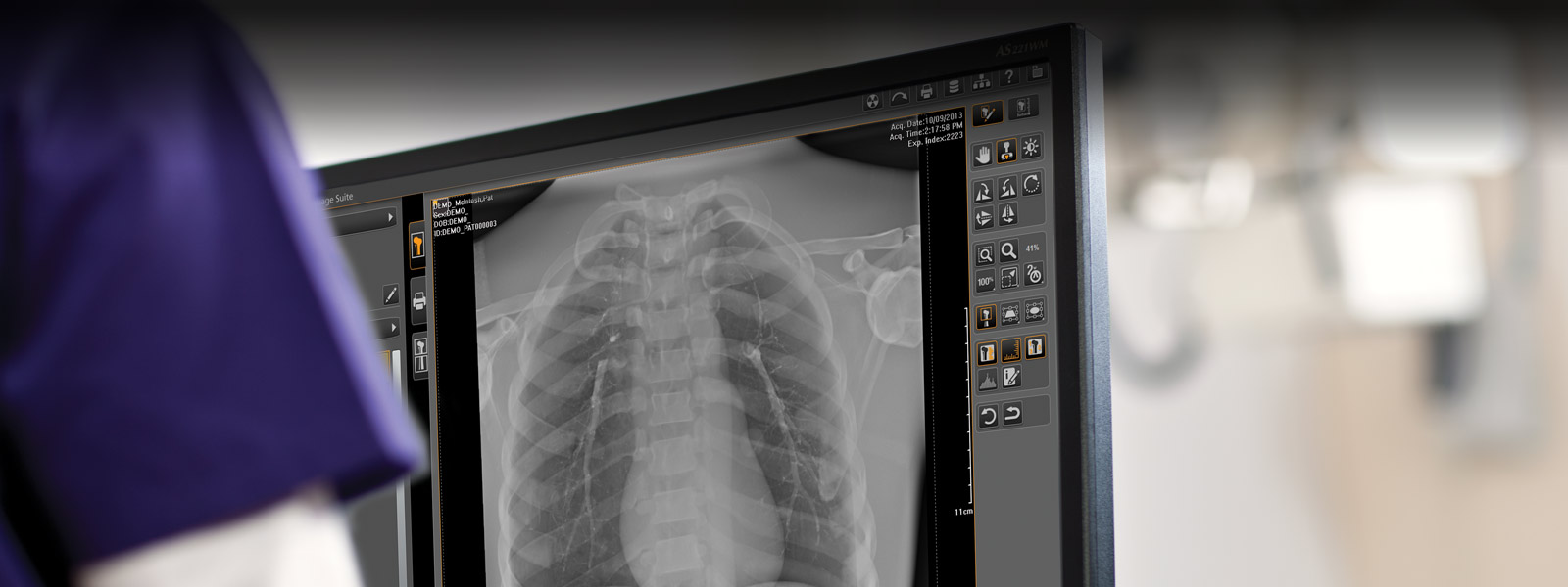 Software Carestream Image Suite