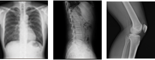 Chest Spine Knee