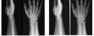 Hands