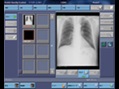 Scan on monitor