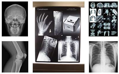 t-image collage