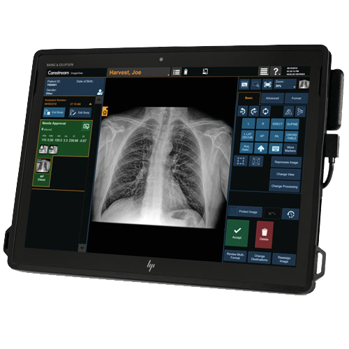 Room or Mobile Retrofit System DRX-Transportable System/Lite