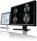 PACS Mammography Workstation