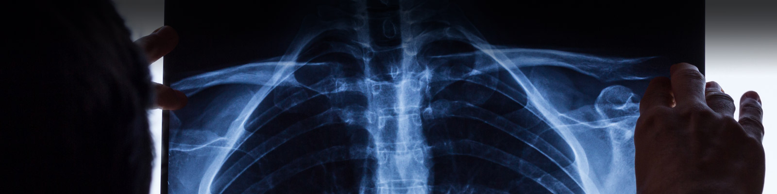 Filmes de radiologia da Carestream