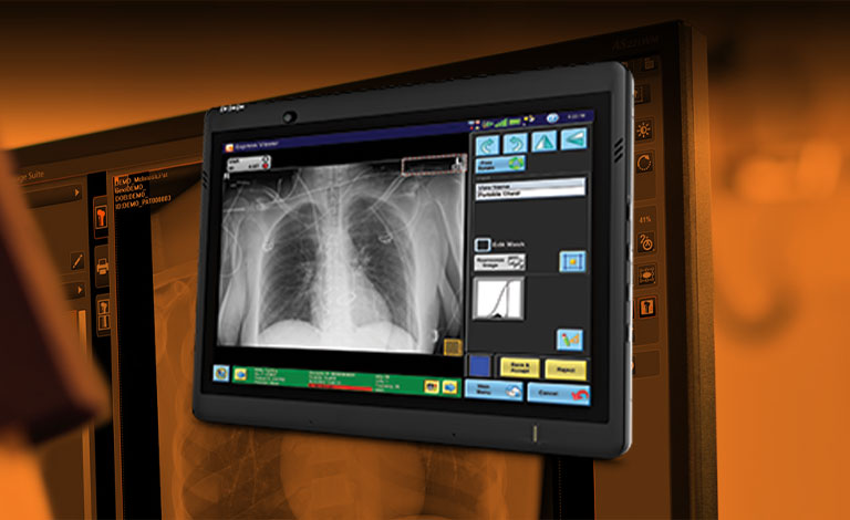 Carestream 推出新软件更新以提升诊断准确性