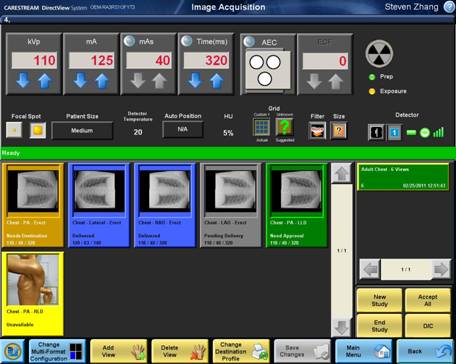 锐珂公司新的 DR 软件简化了剂量管理和曝光数据 锐珂公司新的 DR 软件简化了剂量管理和曝光数据