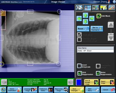 锐珂医疗的 DR 软件使用了同样的用户界面 锐珂医疗的 DR 软件使用了同样的用户界面